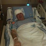 Brain surgery in January